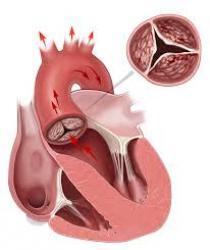 Định nghĩa về định luật laplace trong điện lực học